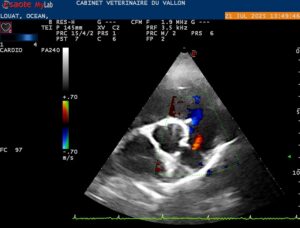 Echocardiographie doppler