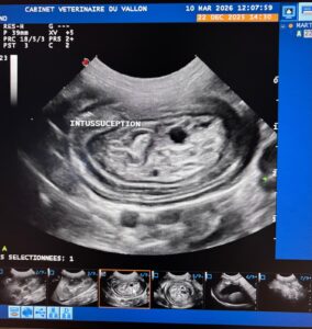 Echographie