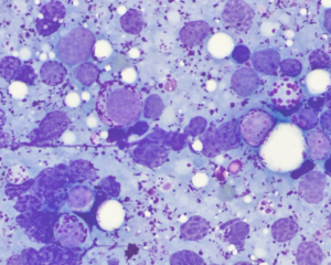 Oncologie