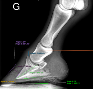 Orthopédie